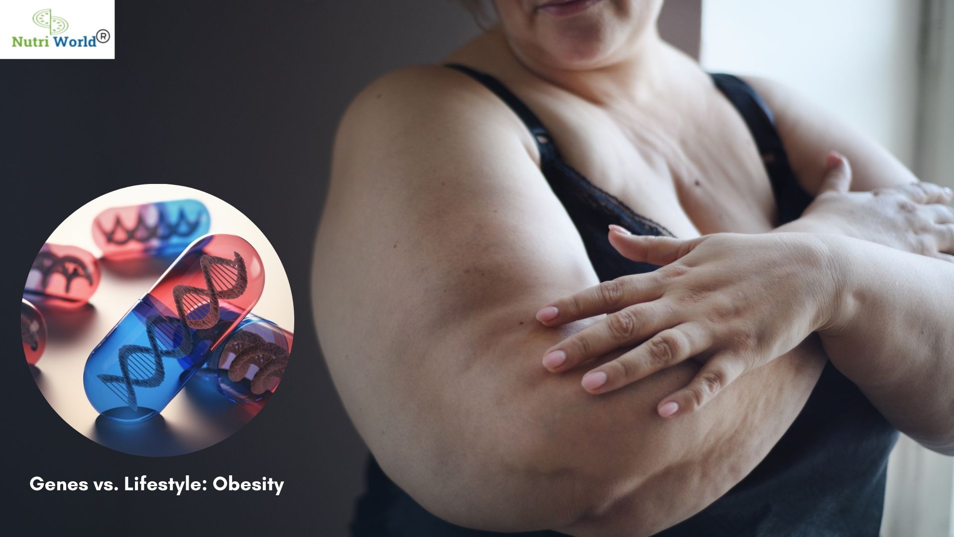 enes vs. Lifestyle What Causes Obesity - nutriworld